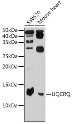 Western Blot: UQCRQ Antibody [NBP2-93506] - Western blot analysis of extracts of various cell lines, using UQCRQ Rabbit pAb (NBP2-93506) at 1:500 dilution. Secondary antibody: HRP Goat Anti-Rabbit IgG (H+L) at 1:10000 dilution. Lysates/proteins: 25ug per lane. Blocking buffer: 3% nonfat dry milk in TBST. Detection: ECL Basic Kit. Exposure time: 180s.